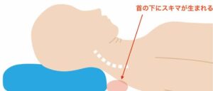 身体に合った枕を使っていても使い方が正しくなければ意味がありません。
枕のポイントは「頭と首を枕でしっかり支える」のが正しい枕の使い方です。

仰向けで寝た時に枕のふちに肩が当たって首の後ろに隙間がない状態が正しい枕を利用した寝姿勢になります。
首の後ろに隙間ができてしまうと、頭と身体の重みを首だけで支えるようになってしまいます。
頭は体重の約10％ほどの重さがあるため、この状態になると首にとても大きな負担がかかるようになります。

また、枕は中央部分がくぼんでいるものが多いため、くぼんでいるところで寝返りを打って横向きになると、首の下に隙間ができやすくなります。
そのため横向きになる時は枕のくぼんでいない端の部分に頭が置けるようにしましょう。