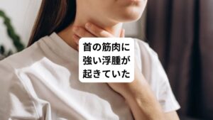 触診を行うと首に強い浮腫が診られました。
この浮腫がある場合、筋肉のこりや緊張が浮腫の下に起きていると考えられます。
今回、筋肉のこりが認められた首の筋肉は以下の通りです。

①胸鎖乳突筋（きょうさにゅうとつきん）
→めまいに関わる代表的な筋です。
頚性めまいと診断されるもののほとんどは胸鎖乳突筋にトリガーポイントが発生しています。

②僧帽筋（そうぼうきん）
→肩に力が入るだけで交感神経が刺激されて興奮します。
自律神経の乱れに関係しています。

③頭半棘筋（とうはんきょくきん）
→自律神経の調整を目的に治療。

上記3つの筋肉を中心に鍼治療を行いました。